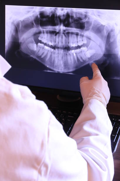 Best Emergency Tooth Extraction in South Lebanon, OH